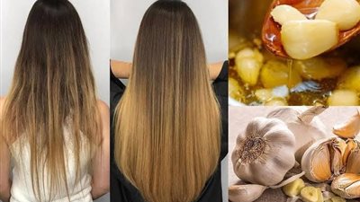 وصفة الثوم لعلاج تساقط الشعر في 7 خطوات