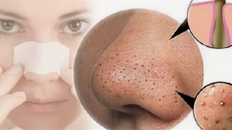 معجون اسنان للقضاء