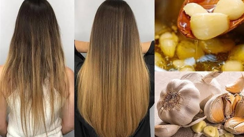 الثوم لعلاج تساقط