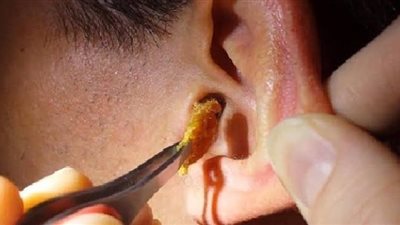 4 طرق فعالة لتنظيف الأذن 