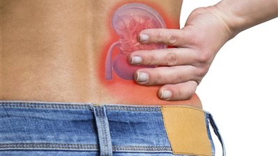 4 مشروبات فعالة للوقاية من حصوات الكلى