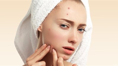 خلطات طبيعية فعالة للتخلص من حبوب الوجه 