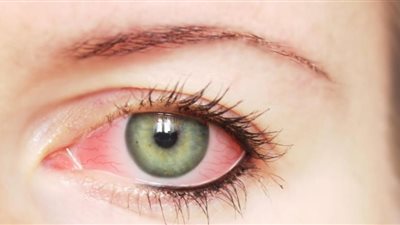 3 علامات في العين تدل على إصابتك بأمراض خطيرة 