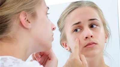 3 علامات في الوجه تشير إلى ارتفاع نسبة الكوليسترول الضار