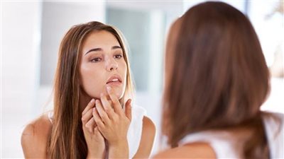 خلطات طبيعية فعالة للتخلص من الحبوب تحت الجلد