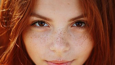 تفسير رؤية النمش في المنام للعزباء والمتزوجة والحامل