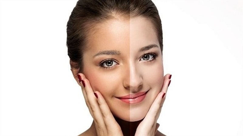 علاج حروق الشمس